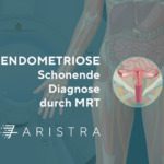 Endometriose: Schonende Diagnose durch MRT