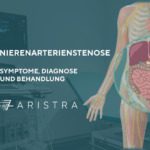 Nierenarterienstenose – Symptome, Diagnose und Behandlung